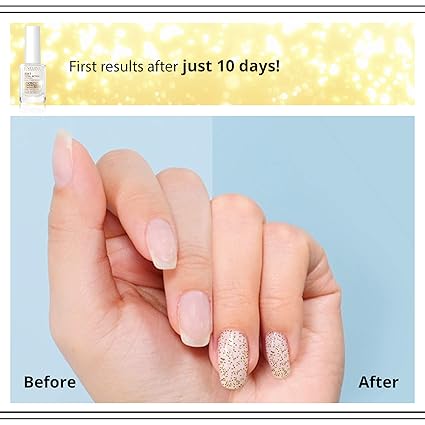 Eveline Cosmetics - 8-in-1 Nail Conditioner with Golden Particles (Original)